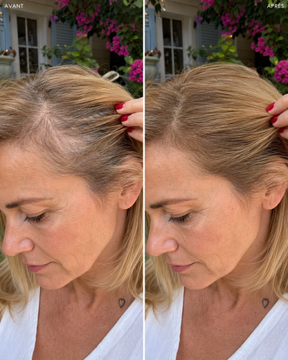 Correcteur Cuir Chevelu  Estim Paris