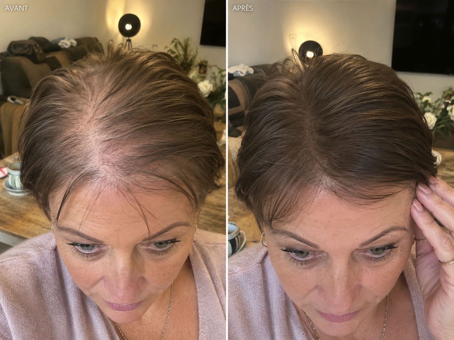 Correcteur Cuir Chevelu  Estim Paris